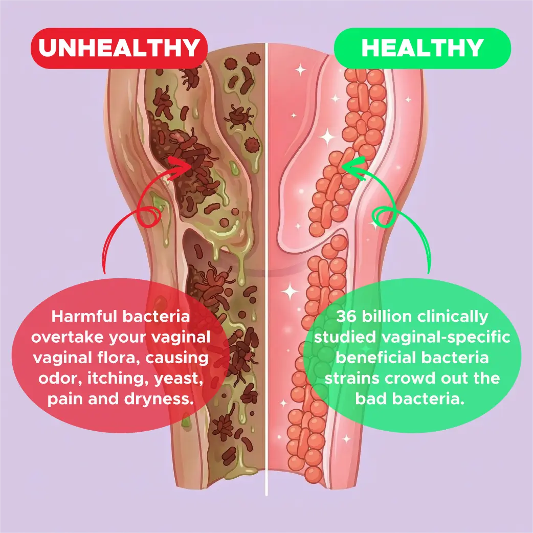 Infographic comparing unhealthy and healthy bladder: bad bacteria on the bladder wall versus VeFlora cranberry PACs acting as a shield so bacteria flush out with urine.